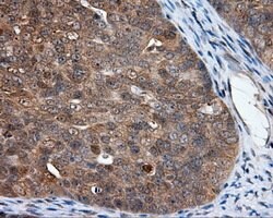 NPR3 Mouse anti-Human, Clone: OTI4A1, lyophilized, TrueMAB 100 &mu;g; Unconjugated:Antibodies,
