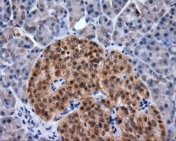 NPR3 Mouse anti-Human, Clone: OTI4A1, lyophilized, TrueMAB 100 &mu;g; Unconjugated:Antibodies,