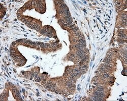 NPR3 Mouse anti-Human, Clone: OTI4A1, lyophilized, TrueMAB 100 &mu;g; Unconjugated:Antibodies,