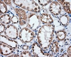 NPR3 Mouse anti-Human, Clone: OTI4A1, lyophilized, TrueMAB 100 &mu;g; Unconjugated:Antibodies,