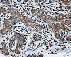 NPR3 Monoclonal Antibody (OTI11B6), TrueMAB , OriGene 30 &mu;L; Unconjugated:Antibodies,