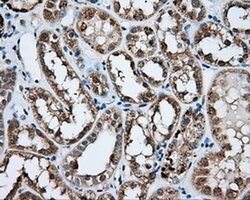 NPR3 Mouse anti-Human, Clone: OTI11H6, liquid, TrueMAB 30 &mu;L; Unconjugated:Antibodies,