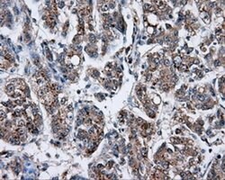 NPR3 Mouse anti-Human, Clone: OTI11H6, liquid, TrueMAB 30 &mu;L; Unconjugated:Antibodies,