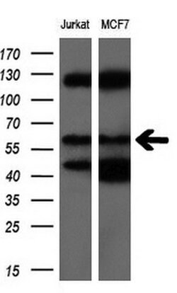 NPR3 Monoclonal Antibody (OTI2C2), TrueMAB , OriGene 100 &mu;L; Unconjugated:Antibodies,