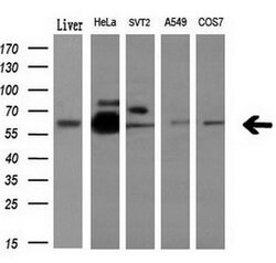 NPR3 Mouse anti-Human, Clone: OTI4H1, lyophilized, TrueMAB 100 &mu;g; Unconjugated:Antibodies,