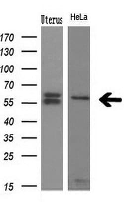 NPR3 Monoclonal Antibody (OTI11H5), TrueMAB , OriGene 30 &mu;L | Buy Online | Origene Technologies | Fisher Scientific