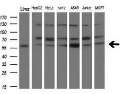 NPR3 Mouse anti-Human, Clone: OTI11H6, liquid, TrueMAB 30 &mu;L; Unconjugated:Antibodies,