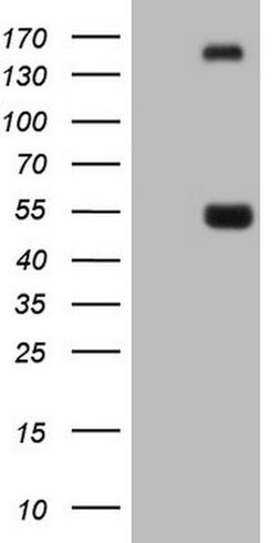 NPTX1 Mouse anti-Human, Clone: OTI5G9, lyophilized, TrueMAB 100 &mu;g;