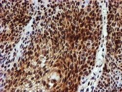 NQO2 Monoclonal Antibody (OTI3G4), TrueMAB , OriGene 100 &mu;L; Unconjugated:Antibodies,