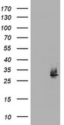 NQO2 Mouse anti-Canine, Human, Clone: OTI3C11, liquid, TrueMAB 30 &mu;L;