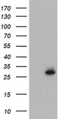 NQO2 Monoclonal Antibody (OTI4B2), TrueMAB , OriGene 100 &mu;L; Unconjugated:Antibodies,