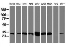 NQO2 Monoclonal Antibody (OTI3G4), TrueMAB , OriGene 100 &mu;L; Unconjugated:Antibodies,