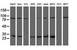NQO2 Mouse anti-Canine, Human, Clone: OTI1G2, lyophilized, TrueMAB 100