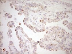 NR0B2 Mouse anti-Human, Clone: OTI5F10, lyophilized, TrueMAB 100 &mu;g;