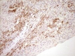 NR0B2 Mouse anti-Human, Clone: OTI5F10, lyophilized, TrueMAB 100 &mu;g;