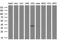 NR0B2 Monoclonal Antibody (OTI1A2), TrueMAB , OriGene 100 &mu;L; Unconjugated:Antibodies,
