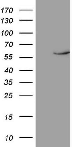 NR1D2 Monoclonal Antibody (OTI5E10), TrueMAB , OriGene 100 &mu;L; Unconjugated:Antibodies,