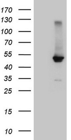 NR1H4 Mouse anti-Human, Clone: OTI4F12, liquid, TrueMAB 100 &mu;L; Unconjugated:Anticuerpos