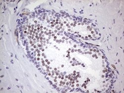 NR1I3 Monoclonal Antibody (OTI10F9), TrueMAB , OriGene:Antibodies:Primary