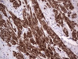 NR1I3 Mouse anti-Human, Clone: OTI1C6, lyophilized, TrueMAB 100 &mu;g;