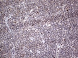 NR1I3 Mouse anti-Human, Clone: OTI1C6, lyophilized, TrueMAB 100 &mu;g;