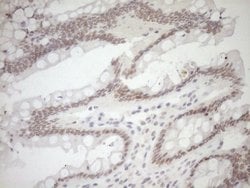 NR1I3 Monoclonal Antibody (OTI10B1), TrueMAB , OriGene:Antibodies:Primary