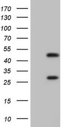 NR1I3 Mouse anti-Human, Clone: OTI1B2, lyophilized, TrueMAB 100 &mu;g;