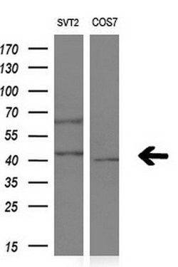 NR1I3 Mouse anti-Human, Clone: OTI1B2, lyophilized, TrueMAB 100 &mu;g;