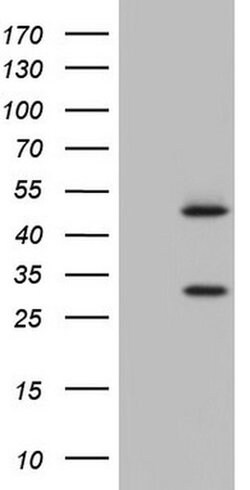NR1I3 Monoclonal Antibody (OTI9E4), TrueMAB , OriGene 100 &mu;L; Unconjugated:Antibodies,