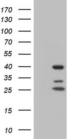 NR1I3 Mouse anti-Human, Clone: OTI10F9, lyophilized, TrueMAB 100 &mu;g;