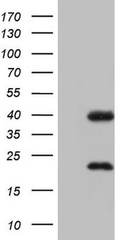 NR1I3 Mouse anti-Human, Clone: OTI1C6, lyophilized, TrueMAB 100 &mu;g;