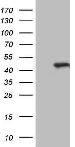 NR1I3 Monoclonal Antibody (OTI9E1), TrueMAB , OriGene:Antibodies:Primary
