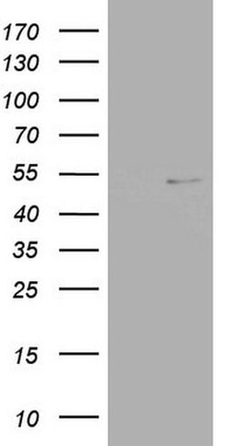 NR2C1 Monoclonal Antibody (OTI1E9), TrueMAB , OriGene:Antibodies:Primary