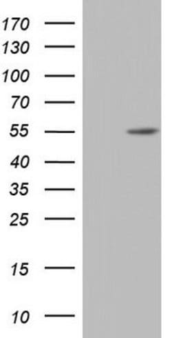 NR2C1 Mouse anti-Human, Clone: OTI1C5, lyophilized, TrueMAB 100 &mu;g;
