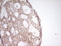 NR2C2 Mouse anti-Human, Clone: OTI1F3, lyophilized, TrueMAB 100 &mu;g;