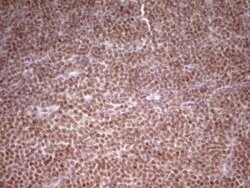 NR2C2 Mouse anti-Human, Clone: OTI1F3, lyophilized, TrueMAB 100 &mu;g;
