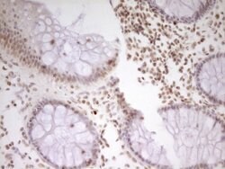 NR2C2 Mouse anti-Human, Clone: OTI1F3, lyophilized, TrueMAB 100 &mu;g;