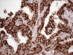 NR2C2 Mouse anti-Human, Clone: OTI1B1, lyophilized, TrueMAB 100 &mu;g;
