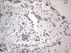 NR2C2 Monoclonal Antibody (OTI2H2), TrueMAB , OriGene 100 &mu;L; Unconjugated:Antibodies,