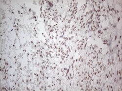NR2C2 Monoclonal Antibody (OTI2H2), TrueMAB , OriGene 100 &mu;L; Unconjugated:Antibodies,