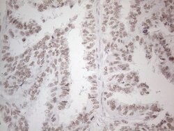 NR2C2 Monoclonal Antibody (OTI2H2), TrueMAB , OriGene 100 &mu;L; Unconjugated:Antibodies,