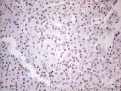 NR2C2 Monoclonal Antibody (OTI2H2), TrueMAB , OriGene 100 &mu;L; Unconjugated:Antibodies,