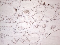 NR2C2 Monoclonal Antibody (OTI2H2), TrueMAB , OriGene 100 &mu;L; Unconjugated:Antibodies,