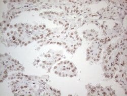 NR2C2 Monoclonal Antibody (OTI2H2), TrueMAB , OriGene 100 &mu;L; Unconjugated:Antibodies,