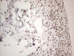 NR2C2 Monoclonal Antibody (OTI2H2), TrueMAB , OriGene 100 &mu;L; Unconjugated:Antibodies,