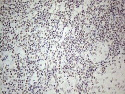 NR2C2 Monoclonal Antibody (OTI2H2), TrueMAB , OriGene 100 &mu;L; Unconjugated:Antibodies,