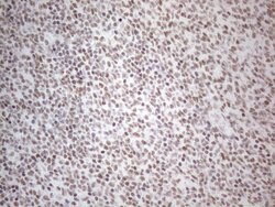 NR2C2 Monoclonal Antibody (OTI2H2), TrueMAB , OriGene 100 &mu;L; Unconjugated:Antibodies,
