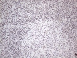 NR2C2 Monoclonal Antibody (OTI2H2), TrueMAB , OriGene 100 &mu;L; Unconjugated:Antibodies,
