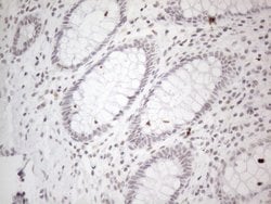 NR2C2 Monoclonal Antibody (OTI2H2), TrueMAB , OriGene 100 &mu;L; Unconjugated:Antibodies,