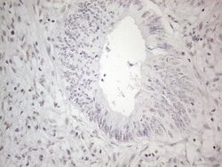 NR2C2 Monoclonal Antibody (OTI2H2), TrueMAB , OriGene:Antibodies:Primary